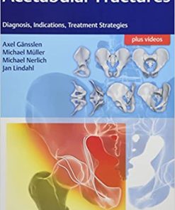 Acetabular Fractures Diagnosis Indications Treatment Strategies
