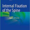 Internal Fixation of the Spine Principles and Practice