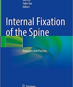 Internal Fixation of the Spine Principles and Practice