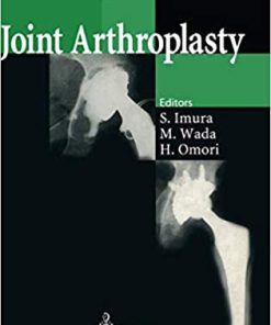 Joint Arthroplasty By Noriya Akamatsu