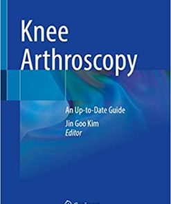 Knee Arthroscopy An Up to Date Guide