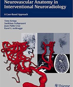 Neurovascular Anatomy in Interventional Neuroradiology A Case Based Approach
