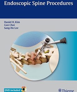 Endoscopic Spine Procedures