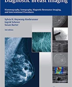 Diagnostic Breast Imaging Mammography Sonography MRI and Interventional Procedures 3rd Edition