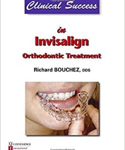 Clinical Success in Invisalign Orthodontic Treatment