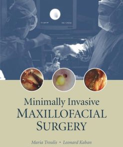 Minimally Invasive Maxillofacial Surgery By Maria Troulis