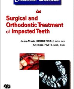 Clinical Success in Surgical And Orthodontic Treatment of Impacted Teeth