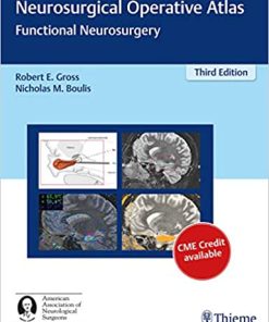 Neurosurgical Operative Atlas Functional Neurosurgery 3rd Edition