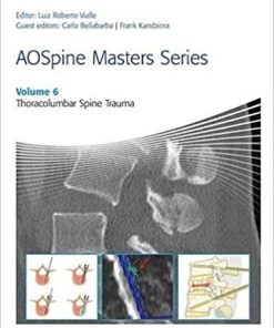 AOSpine Masters Series Volume 6 Thoracolumbar Spine Trauma