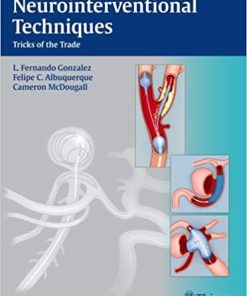 Neurointerventional Techniques Tricks of the Trade