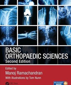 Basic Orthopaedic Sciences 2nd Edition