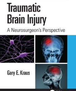 Traumatic Brain Injury A Neurosurgeons Perspective