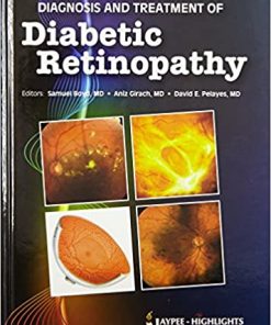Diagnosis and Treatment of Diabetic Retinopathy