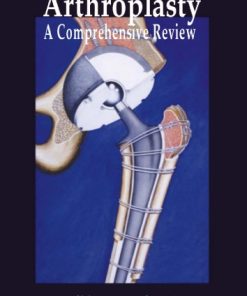Arthroplasty A Comprehensive Review