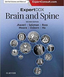 ExpertDDx Brain and Spine 2nd Edition