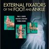 External Fixators of the Foot and Ankle