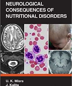 Neurological Consequences of Nutritional Disorders