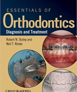 Essentials of Orthodontics Diagnosis and Treatment