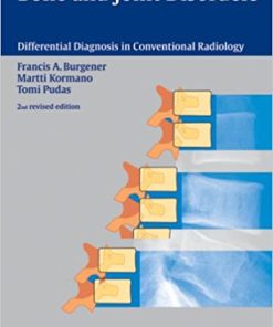 Bone and Joint Disorders 2nd Edition