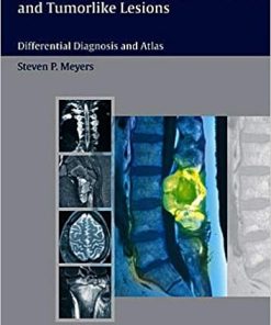MRI of Bone and Soft Tissue Tumors and Tumorlike Lesions Differential Diagnosis and Atlas