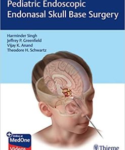 Pediatric Endoscopic Endonasal Skull Base Surgery