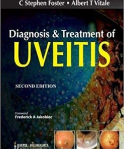 Diagnosis and Treatment of Uveitis
