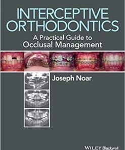 Interceptive Orthodontics A Practical Guide To Occlusal Management