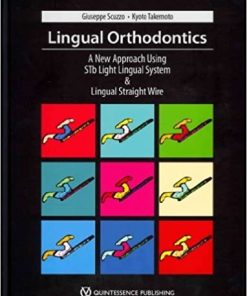 Lingual Orthodontics A New Approach Using Stb Light Lingual System & Lingual Straight Wire