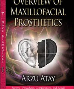 Overview of Maxillofacial Prosthetics