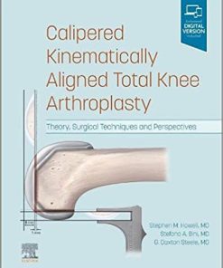 Calipered Kinematically aligned Total Knee Arthroplasty Theory Surgical Techniques and Perspectives