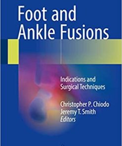 Foot and Ankle Fusions Indications and Surgical Techniques