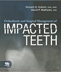Orthodontic and Surgical Management of Impacted Teeth