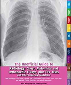 Unofficial Guide to Radiology Chest Abdominal and Orthopaedic X Rays Plus CTs MRIs and Other Important Modalities Core Radiology Curriculum
