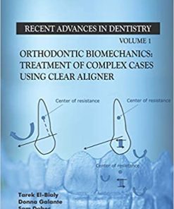 Orthodontic Biomechanics Treatment Of Complex Cases Using Clear Aligner