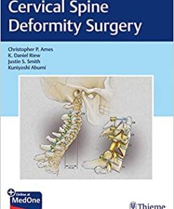 Cervical Spine Deformity Surgery