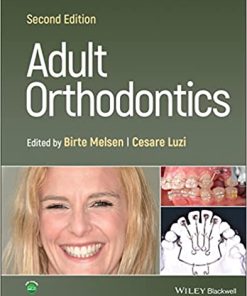 Adult Orthodontics 2nd Edition