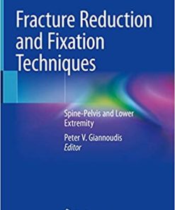 Fracture Reduction and Fixation Techniques Spine Pelvis and Lower Extremity
