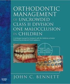 Orthodontic Management of Uncrowded Class II Division One Malocclusion in Children