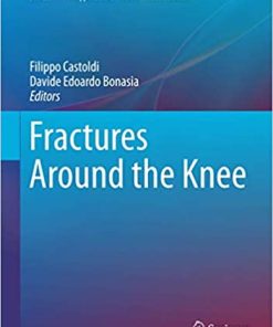Fractures Around the Knee