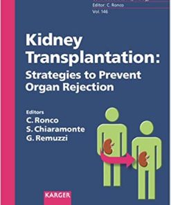Kidney Transplantation Strategies to Prevent Organ Rejection