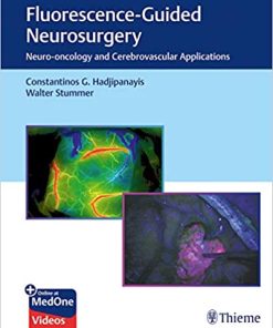 Fluorescence Guided Neurosurgery Neuro Oncology and Cerebrovascular Applications