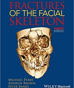 Fractures of the Facial Skeleton 2nd Edition By Peter Banks