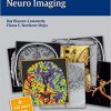 Radcases Neuro Imaging
