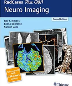RadCases Plus Q&A Neuro Imaging 2nd Edition