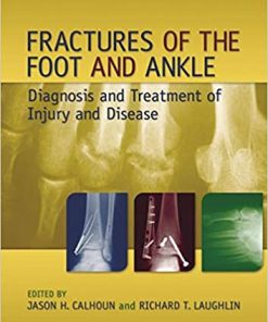 Fractures of the Foot and Ankle Diagnosis and Treatment of Injury and Disease