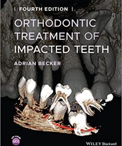 Orthodontic Treatment of Impacted Teeth 4th Edition
