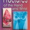 Fractures of the Hand and Wrist