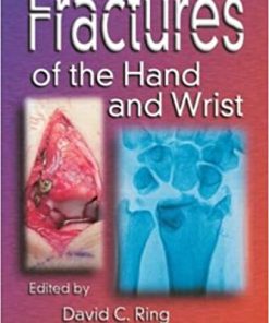 Fractures of the Hand and Wrist