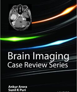 Brain Imaging Case Review Series