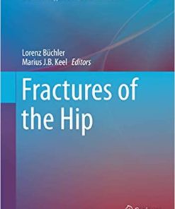 Fractures of the Hip